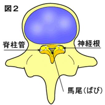 脊柱管狭窄症　画像